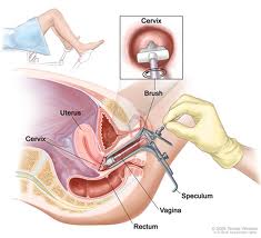 Exame de prevenção do câncer de colo uterino